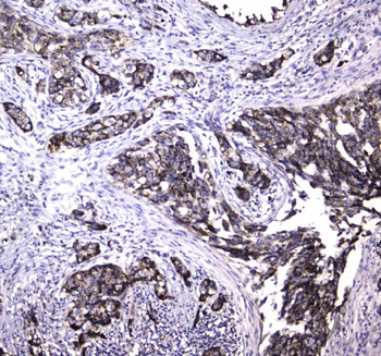 MRE11/MRE11 Rabbit Polyclonal Antibody