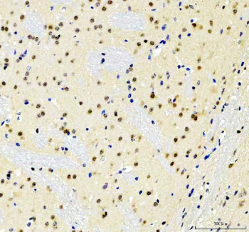 SOX10 Rabbit Polyclonal Antibody