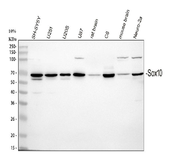 SOX10 Rabbit Polyclonal Antibody