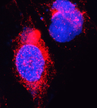 DYRK1A Rabbit Polyclonal Antibody