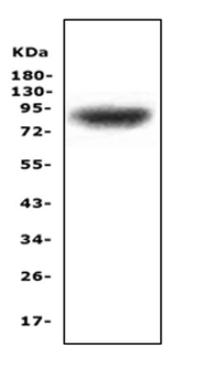 MAP3K20 Rabbit Polyclonal Antibody