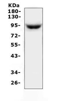 MAP3K20 Rabbit Polyclonal Antibody