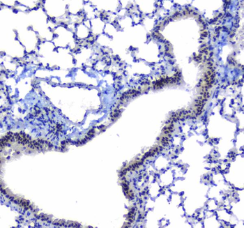 splicing factor 1/SF1 Rabbit Polyclonal Antibody