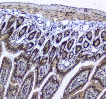 splicing factor 1/SF1 Rabbit Polyclonal Antibody