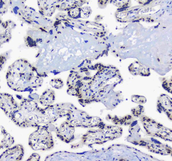 splicing factor 1/SF1 Rabbit Polyclonal Antibody