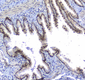 splicing factor 1/SF1 Rabbit Polyclonal Antibody