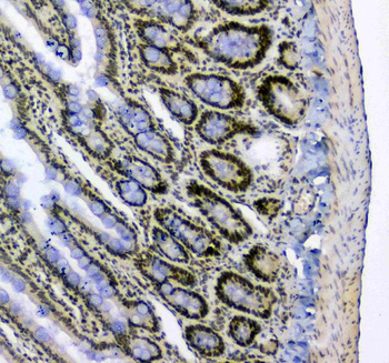 splicing factor 1/SF1 Rabbit Polyclonal Antibody
