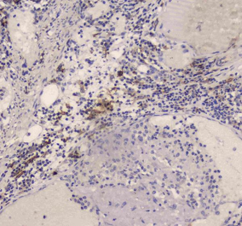 DC-SIGN/CD209/DC Rabbit Polyclonal Antibody