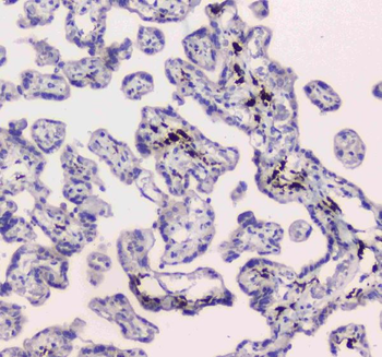 DC-SIGN/CD209/DC Rabbit Polyclonal Antibody