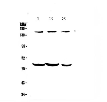 KCNH1 Rabbit Polyclonal Antibody