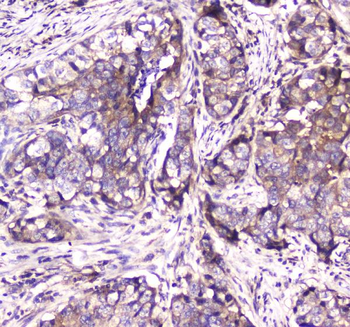 SDHB Rabbit Polyclonal Antibody