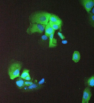14-3-3 sigma/SFN/14 Rabbit Polyclonal Antibody