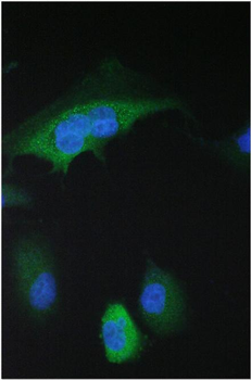 14-3-3 sigma/SFN/14 Rabbit Polyclonal Antibody
