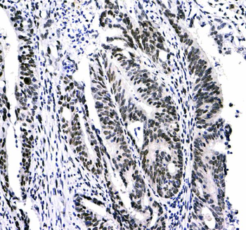 HP1 gamma/CBX3 Rabbit Polyclonal Antibody