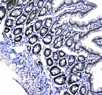 HP1 gamma/CBX3 Rabbit Polyclonal Antibody