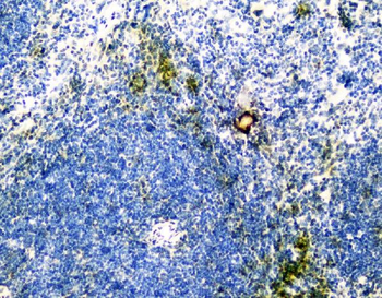 VCAM1 Rabbit Polyclonal Antibody