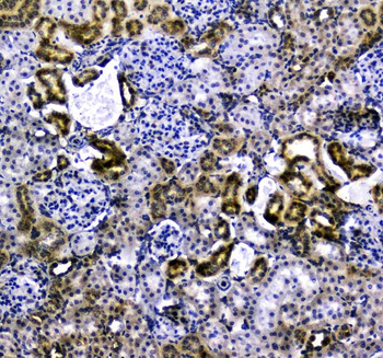 VCAM1 Rabbit Polyclonal Antibody