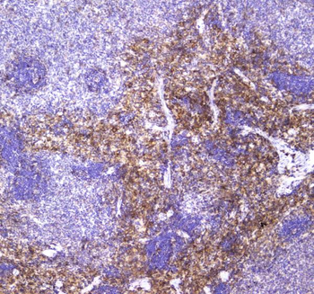VCAM1 Rabbit Polyclonal Antibody