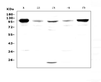 VCAM1 Rabbit Polyclonal Antibody