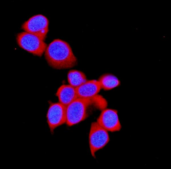 STUB1 Rabbit Polyclonal Antibody