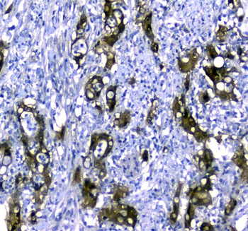 STUB1 Rabbit Polyclonal Antibody