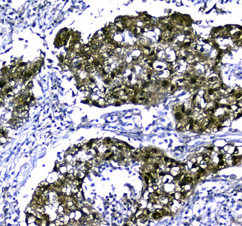 STUB1 Rabbit Polyclonal Antibody