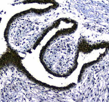 STUB1 Rabbit Polyclonal Antibody