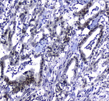 MDC1 Rabbit Polyclonal Antibody