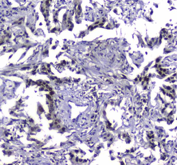 MDC1 Rabbit Polyclonal Antibody
