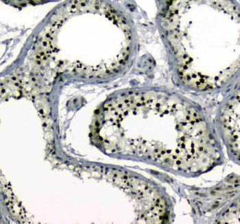 MDC1 Rabbit Polyclonal Antibody