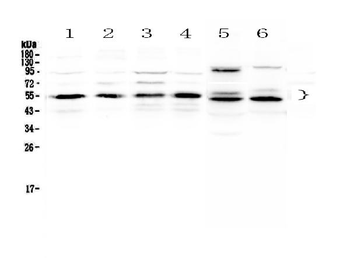 Retinoid X Receptor alpha/RXRA Rabbit Polyclonal Antibody