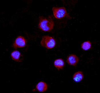 CD16/FCGR3A Rabbit Polyclonal Antibody
