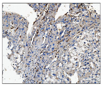 CD16/FCGR3A Rabbit Polyclonal Antibody