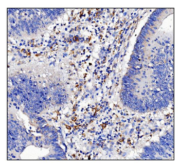 CD16/FCGR3A Rabbit Polyclonal Antibody