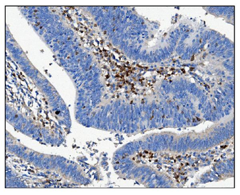 CD16/FCGR3A Rabbit Polyclonal Antibody