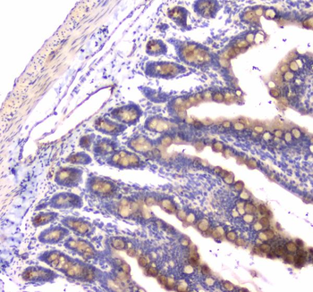 RAB27A Rabbit Polyclonal Antibody