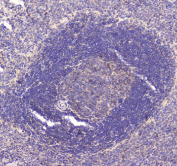 RAB27A Rabbit Polyclonal Antibody