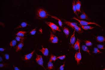 cIAP1/BIRC2 Rabbit Polyclonal Antibody
