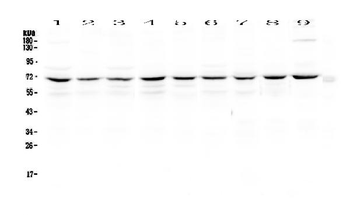 cIAP1/BIRC2 Rabbit Polyclonal Antibody