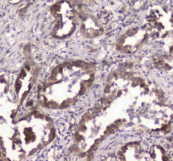 GLO1 Rabbit Polyclonal Antibody