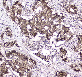 GLO1 Rabbit Polyclonal Antibody