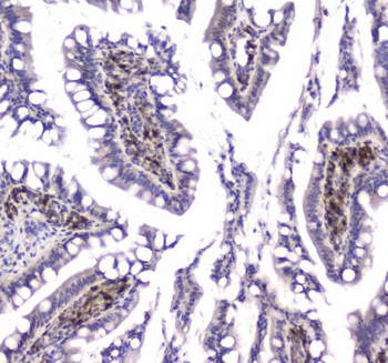 GLO1 Rabbit Polyclonal Antibody