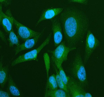 CD2AP Rabbit Polyclonal Antibody
