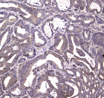 HTRA1 Rabbit Polyclonal Antibody