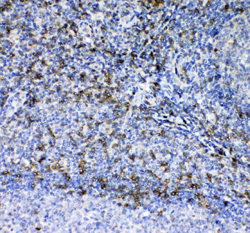 CD7 Rabbit Polyclonal Antibody