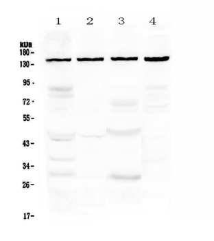 TRPC4 Rabbit Polyclonal Antibody