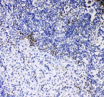 CD8 alpha/Cd8a Rabbit Polyclonal Antibody