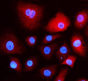 EEA1 Rabbit Polyclonal Antibody