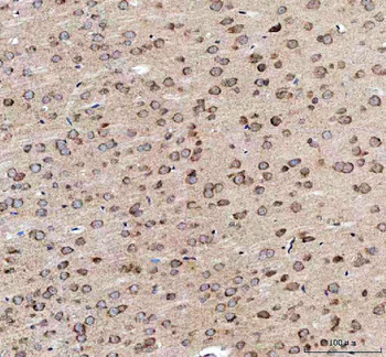 EEA1 Rabbit Polyclonal Antibody