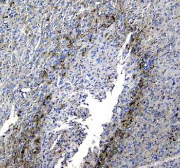 Synaptotagmin 1/SYT1 Rabbit Polyclonal Antibody